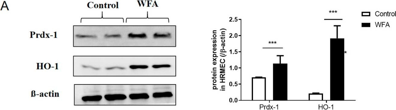 Fig.5.A showing Western Blotting from the publication: Withaferin a Attenuates Retinal Ischemia-Reperfusion Injury via Akt-Dependent Inhibition of Oxidative Stress.