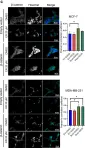 Fig.4.C showing Immunocytochemistry-immunofluorescence in a Homo sapiens (Human) sample from the publication: Ergosterol inhibits the proliferation of breast cancer cells by suppressing AKT/GSK-3beta/beta-catenin pathway.