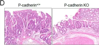 Fig.3.D showing Immunohistochemistry from the publication: P-Cadherin Regulates Intestinal Epithelial Cell Migration and Mucosal Repair, but Is Dispensable for Colitis Associated Colon Cancer.