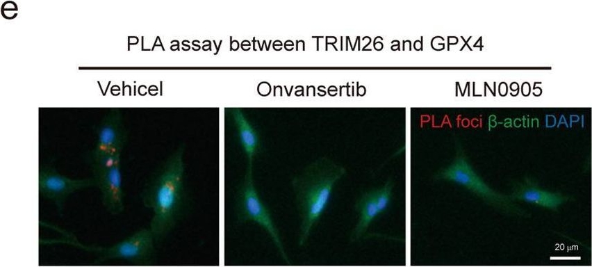 Fig.5.E showing Immunocytochemistry-immunofluorescence from the publication: The E3 ligase TRIM26 suppresses ferroptosis through catalyzing K63-linked ubiquitination of GPX4 in glioma.