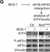 Fig.2.G showing Western Blotting from the publication: Prime editing links the split integrated stress response to pathogenic eIF2B mutations and white matter degeneration.