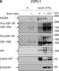 Fig.2.B showing Western Blotting in a Homo sapiens (Human) sample from the publication: IGF-1R nuclear import and recruitment to chromatin involves both alpha and beta subunits.