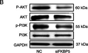 Fig.8.B showing Western Blotting in a Homo sapiens (Human) sample from the publication: miR‑100‑5p and miR‑203a‑3p suppress esophageal squamous cell carcinoma progression by targeting FKBP5.