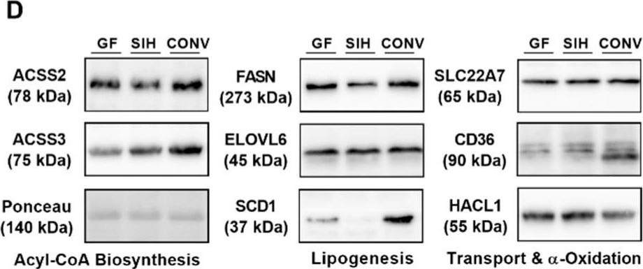 Fig.2.D showing Western Blotting in a Mus musculus (House mouse) sample from the publication: Effect of Microbial Status on Hepatic Odd-Chain Fatty Acids Is Diet-Dependent.