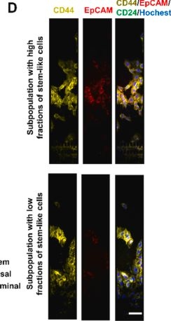 Fig.4.D showing Immunocytochemistry-immunofluorescence from the publication: Phenotypic plasticity and secretory heterogeneity in subpopulations derived from single cancer cell.