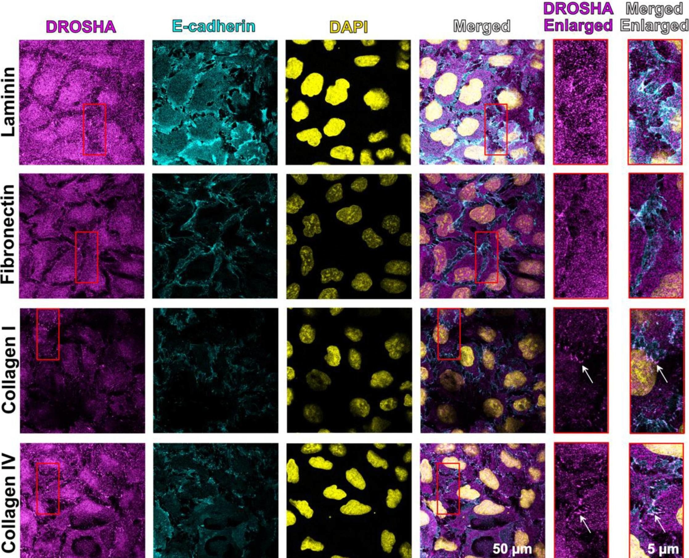 Fig.5.A showing Immunofluorescence in a Homo sapiens (Human) sample from the publication: ECM Substrates Impact RNAi Localization at Adherens Junctions of Colon Epithelial Cells.