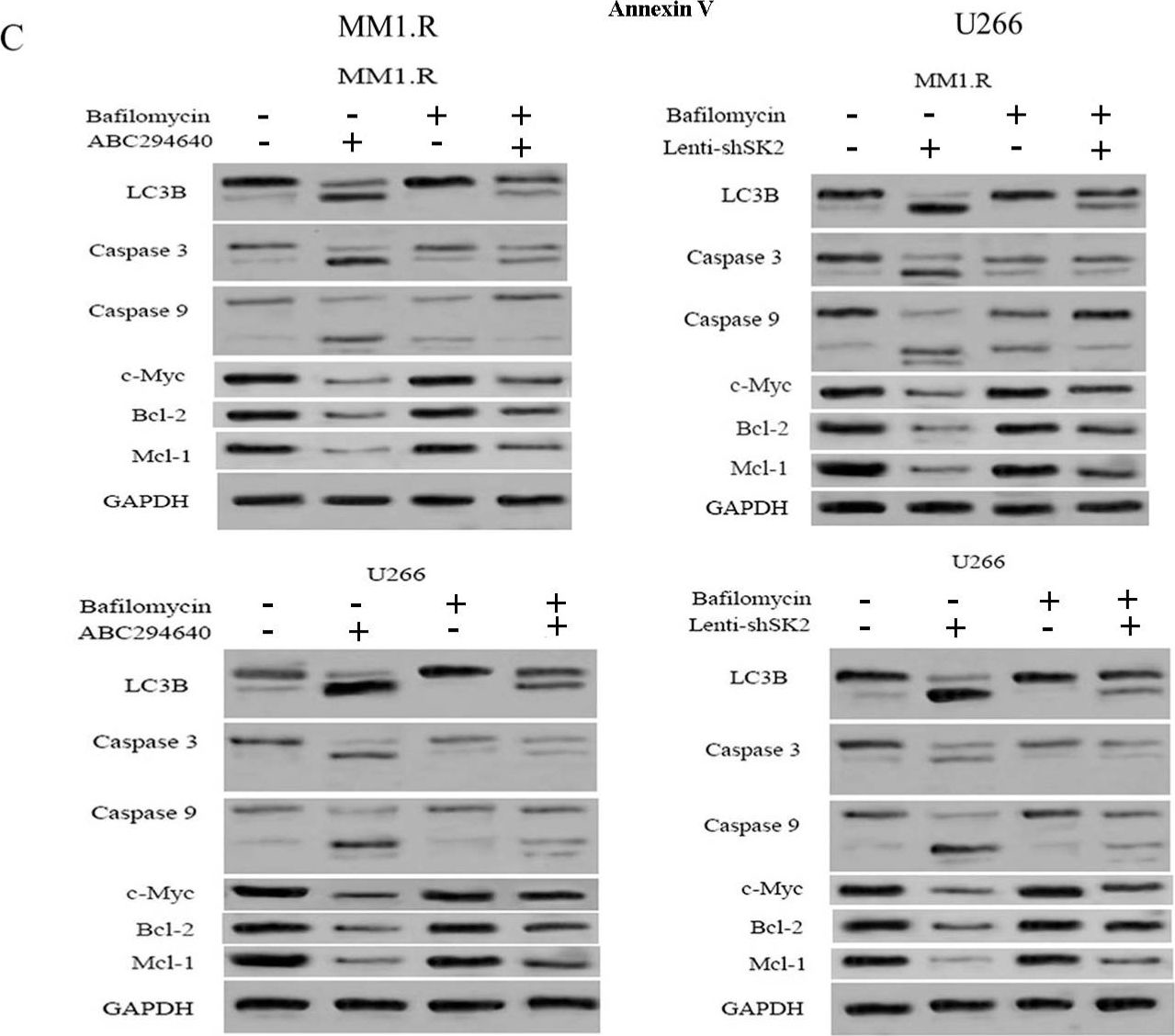Fig.3.C showing Western Blotting from the publication: Inhibition of Sphingosine Kinase 2 Results in PARK2-Mediated Mitophagy and Induces Apoptosis in Multiple Myeloma.
