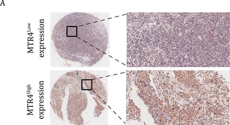 Fig.1.A showing Immunohistochemistry from the publication: RNA helicase MTR4 drives tumorigenesis of nasopharyngeal carcinoma by regulating the expression of key cell cycle genes.