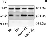Fig.6.C showing Western Blotting from the publication: TIGAR promotes osteogenic differentiation and ameliorates glucocorticoid-induced osteoporosis via autophagy-Nrf2-ROS axis.