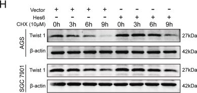 Fig.4.H showing Western Blotting from the publication: Transcription cofactor Hes6 interacts with Twist1 to facilitate EMT and promote gastric carcinogenesis by activating the PI3K/AKT signaling.