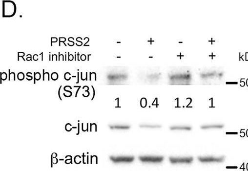 Fig.3.D showing Western Blotting in a Homo sapiens (Human) sample from the publication: PRSS2 remodels the tumor microenvironment via repression of Tsp1 to stimulate tumor growth and progression.