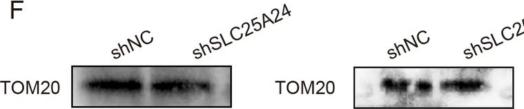 Fig.15.F showing Western Blotting in a Homo sapiens (Human) sample from the publication: VEZT promotes pancreatic cancer progression by stabilizing SLC25A24 and preserving mitochondrial function.