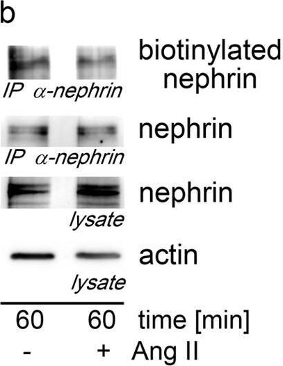 Angiotensin II increases glomerular permeability by β-arrestin mediated nephrin endocytosis.