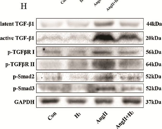 Fig.7.H showing Western Blotting from the publication: Hydrogen decreases susceptibility to AngII-induced atrial fibrillation and atrial fibrosis via the NOX4/ROS/NLRP3 and TGF-β1/Smad2/3 signaling pathways.