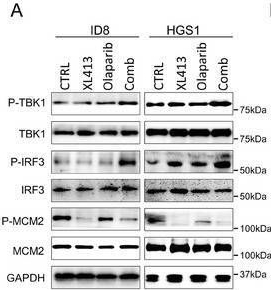 Fig.5.A showing Western Blotting in a Mus musculus (House mouse) sample from the publication: CDC7 Inhibition Potentiates Antitumor Efficacy of PARP Inhibitor in Advanced Ovarian Cancer.