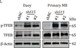 Fig.2.L showing Western Blotting from the publication: AhR-Siglec-15 axis regulates lysosomal Ca2+ release for sonic hedgehog medulloblastoma growth via TRPML1.