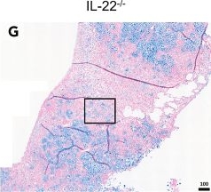 Fig.7.G showing Immunohistochemistry in a Mus musculus (House mouse) sample from the publication: IL-22 and IL-23 regulate the anticryptococcal response during Cryptococcus deuterogattii infection.