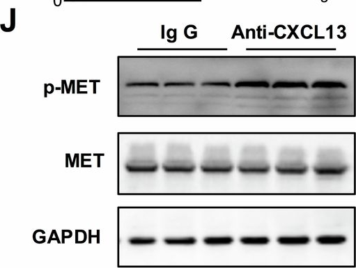 Fig.8.J showing Western Blotting from the publication: CXCL13 suppresses liver regeneration through the negative regulation of HGF signaling.