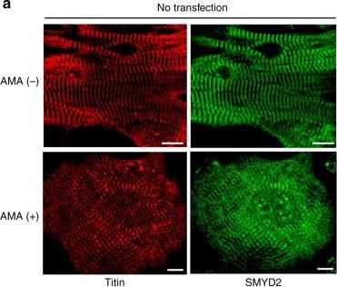Fig.4.A showing Immunocytochemistry-immunofluorescence in a Rattus norvegicus (Rat) sample from the publication: SMYD2 glutathionylation contributes to degradation of sarcomeric proteins.