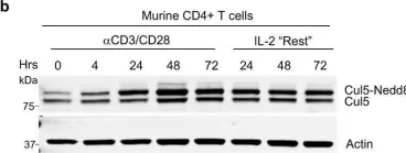 Fig.1.B showing Western Blotting from the publication: The ubiquitin ligase Cul5 regulates CD4+ T cell fate choice and allergic inflammation.