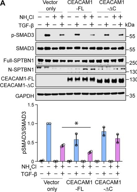 Fig.5.A showing Western Blotting in a Homo sapiens (Human) sample from the publication: Microbial metabolite ammonia disrupts TGF-β signaling to promote colon cancer.