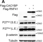 Fig.5.A showing Western Blotting from the publication: CACYBP Enhances Cytoplasmic Retention of P27Kip1 to Promote Hepatocellular Carcinoma Progression in the Absence of RNF41 Mediated Degradation.