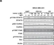 Fig.2.B showing Western Blotting from the publication: Preclinical validation of a novel compound targeting p70S6 kinase in breast cancer.