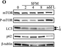 L-leucine and SPNS1 coordinately ameliorate dysfunction of autophagy in mouse and human Niemann-Pick type C disease.