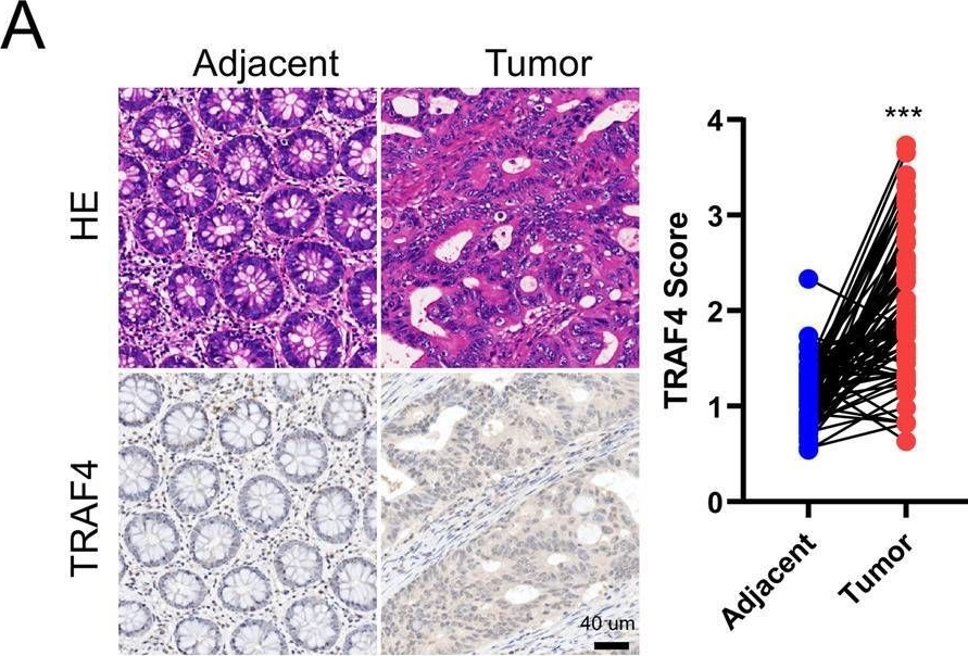 Fig.1.A showing Immunohistochemistry from the publication: TRAF4-mediated ubiquitination-dependent activation of JNK/Bcl-xL drives radioresistance.