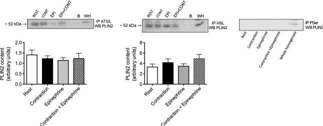 Skeletal muscle PLIN3 and PLIN5 are serine phosphorylated at rest and following lipolysis during adrenergic or contractile stimulation.