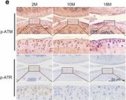 Phospho-ATR (Thr1989) (D5K8W) Rabbit Monoclonal Antibody | Cell