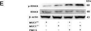 Fig.2.E showing Western Blotting from the publication: MUC1 alleviates PM2.5-induced airway inflammation by inhibiting the IRAK4/NF-κB/NLRP3 mediated pyroptosis in airway epithelial cells.