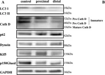 Fig.4.A showing Western Blotting from the publication: Axonal autophagic vesicle transport in the rat optic nerve in vivo under normal conditions and during acute axonal degeneration.