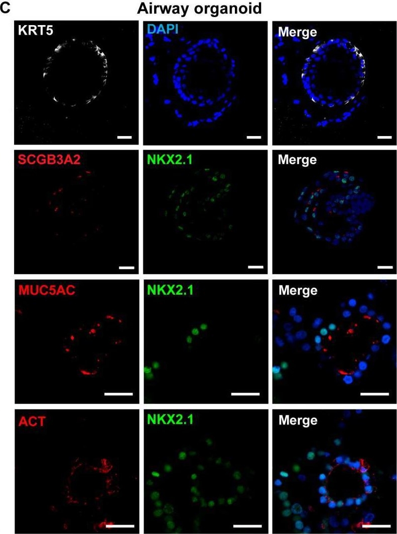 Fig.6.C showing Immunocytochemistry-immunofluorescence in a Homo sapiens (Human) sample from the publication: Role of BMPR2 Mutation in Lung Organoid Differentiation.
