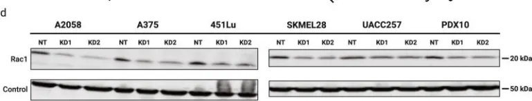 Fig.1.D showing Western Blotting from the publication: SRC-RAC1 signaling drives drug resistance to BRAF inhibition in de-differentiated cutaneous melanomas.