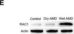 Fig.2.E showing Western Blotting in a Homo sapiens (Human) sample from the publication: Rac1 overexpression promotes Treg-derived cytokines to mediate choroidal neovascularization in wet age-related macular degeneration.