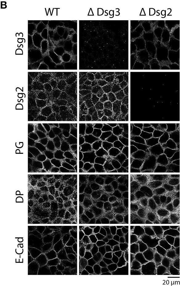 Role of Dsg1- and Dsg3-Mediated Signaling in Pemphigus Autoantibody-Induced Loss of Keratinocyte Cohesion.