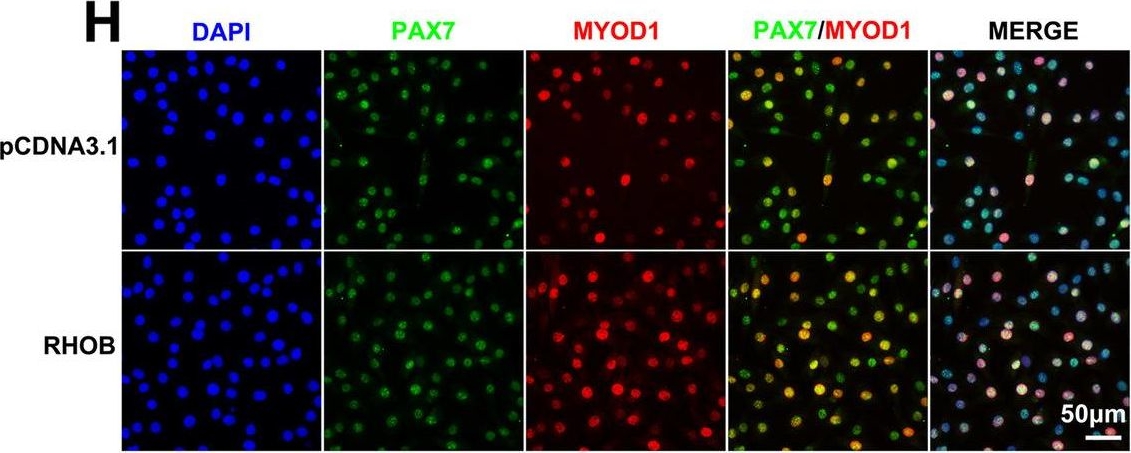 Fig.8.H showing Immunocytochemistry-immunofluorescence in a Sus scrofa domesticus (Domestic pig) sample from the publication: Integrative single-cell RNA-seq and ATAC-seq analysis of myogenic differentiation in pig.