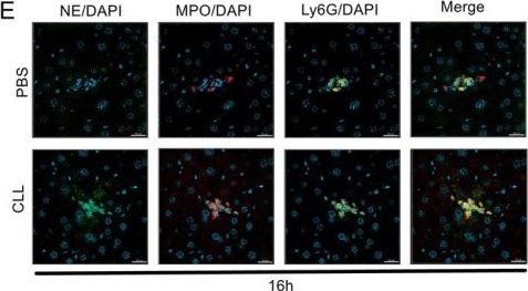 Fig.4.E showing Immunocytochemistry-immunofluorescence in a Mus musculus (House mouse) sample from the publication: Kupffer Cells Regulate iNKT Cells Through Il-12 to Mitigate the Extent of APAP-Induced Damage in the Liver.