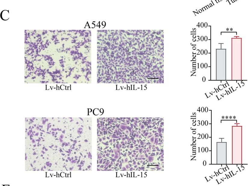 Fig.1.C showing Immunohistochemistry from the publication: Lung cancer cell-intrinsic IL-15 promotes cell migration and sensitizes murine lung tumors to anti-PD-L1 therapy.