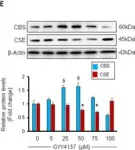 Fig.1.E showing Western Blotting in a Mus musculus (House mouse) sample from the publication: H2S and homocysteine control a novel feedback regulation of cystathionine beta synthase and cystathionine gamma lyase in cardiomyocytes.
