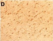 Fig.4.D showing Immunohistochemistry-frozen tissue in a Homo sapiens (Human) sample from the publication: DNA methylation in demyelinated multiple sclerosis hippocampus.