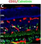 Fig.5.C showing Immunohistochemistry in a Mus musculus (House mouse) sample from the publication: In Utero Alcohol Exposure Impairs Retinal Angiogenesis and the Microvessel-Associated Positioning of Calretinin Interneurons.