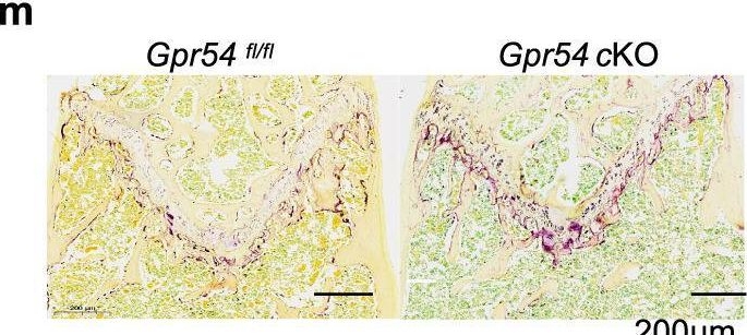 Fig.6.M showing Immunohistochemistry in a Mus musculus (House mouse) sample from the publication: Kisspeptin-10 binding to Gpr54 in osteoclasts prevents bone loss by activating Dusp18-mediated dephosphorylation of Src.