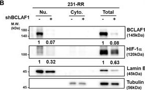 Fig.6.B showing Western Blotting in a Homo sapiens (Human) sample from the publication: BCL2-Associated Transcription Factor 1 Promotes SRC/Hypoxia-Inducible Factor 1 Subunit α-Mediated Cancer Stemness in Radioresistant Triple-Negative Breast Cancer.