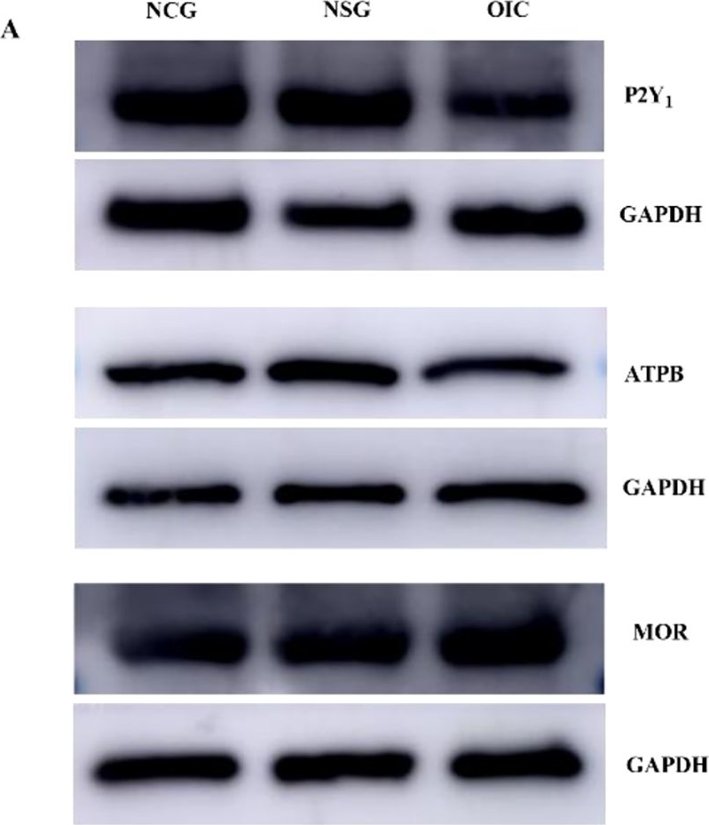 Fig.3.A showing Western Blotting in a Rattus norvegicus (Rat) sample from the publication: The P2Y1 receptor in the colonic myenteric plexus of rats and its correlation with opioid-induced constipation.