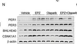 Fig.7.N showing Western Blotting in a Mus musculus (House mouse) sample from the publication: The PRMT6/PARP1/CRL4B Complex Regulates the Circadian Clock and Promotes Breast Tumorigenesis.