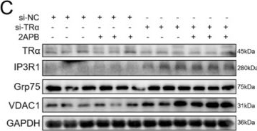Fig.6.C showing Western Blotting in a Mus musculus (House mouse) sample from the publication: Ageing-Dependent Thyroid Hormone Receptor α Reduction Activates IP3R1-Meditated Ca2+ Transfer in MAM and Exacerbates Skeletal Muscle Atrophy in Mice.