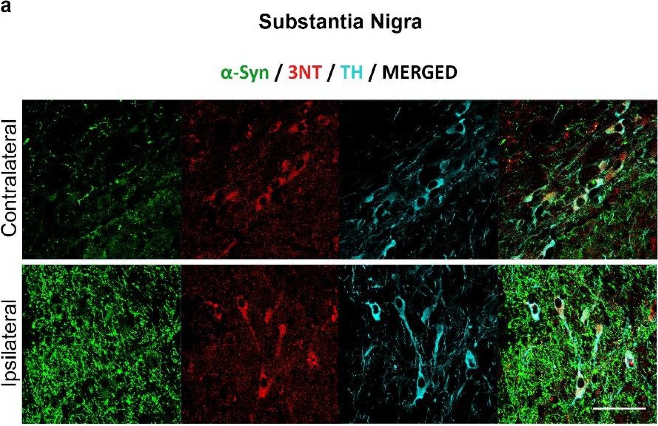 Fig.4.A showing Immunohistochemistry-immunofluorescence in a Mus musculus (House mouse) sample from the publication: Changes in α-Synuclein Posttranslational Modifications in an AAV-Based Mouse Model of Parkinson's Disease.