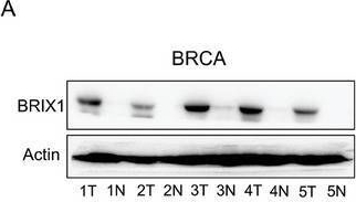 Fig.6.A showing Western Blotting from the publication: Targeting BRIX1 via Engineered Exosomes Induces Nucleolar Stress to Suppress Cancer Progression.